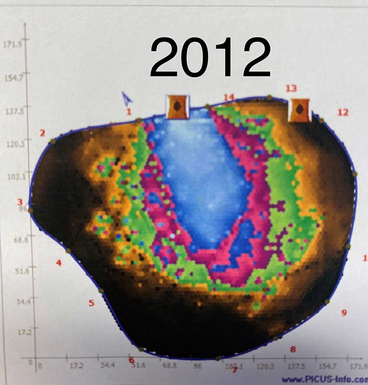 Tomograph images from 2012 and 2016, the blue is decayed timber, the dark brown is solid wood, so the trunk is around one third decayed