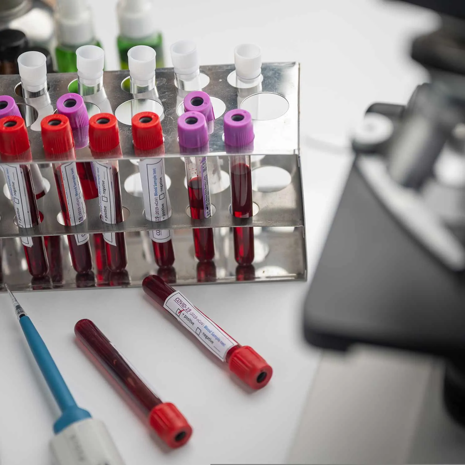 Lab with microscope and vials of plasma in a rack